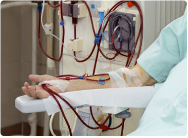 Haemodialysis